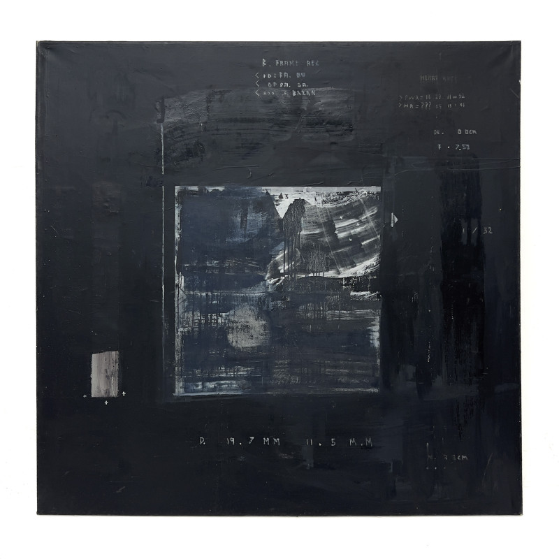 Sergio Bazan - Ecografia I